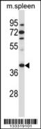 Tubulin-specific chaperone C antibody, 57-065, ProSci, Western Blot image 