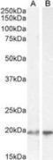 Ubiquitin Conjugating Enzyme E2 C antibody, NB100-1084, Novus Biologicals, Western Blot image 