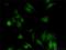 Ubiquitin Conjugating Enzyme E2 G1 antibody, H00007326-M02, Novus Biologicals, Immunocytochemistry image 