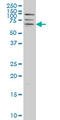 Calcium/Calmodulin Dependent Protein Kinase II Beta antibody, LS-B4292, Lifespan Biosciences, Western Blot image 