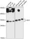 Isoamyl Acetate Hydrolyzing Esterase 1 (Putative) antibody, A14534, Boster Biological Technology, Western Blot image 