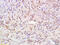 ATPase Family AAA Domain Containing 2 antibody, GTX52041, GeneTex, Immunohistochemistry paraffin image 
