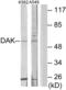 Triokinase And FMN Cyclase antibody, abx013645, Abbexa, Western Blot image 