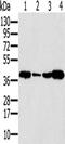 Synaptonemal Complex Protein 3 antibody, CSB-PA729972, Cusabio, Western Blot image 