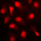 Protein Kinase AMP-Activated Catalytic Subunit Alpha 1 antibody, GTX32345, GeneTex, Immunofluorescence image 