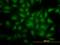 Y-Box Binding Protein 1 antibody, orb375630, Biorbyt, Immunofluorescence image 