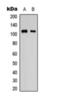 Kinase Suppressor Of Ras 1 antibody, orb393092, Biorbyt, Western Blot image 