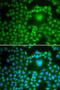 Protein Phosphatase 1 Catalytic Subunit Beta antibody, 15-047, ProSci, Immunofluorescence image 