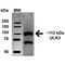 Serine/threonine-protein kinase ULK2 antibody, PA5-77808, Invitrogen Antibodies, Western Blot image 