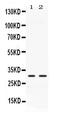 Carbonic Anhydrase 3 antibody, PB10049, Boster Biological Technology, Western Blot image 