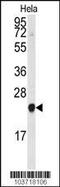 Phosphatidylethanolamine Binding Protein 1 antibody, MBS9202785, MyBioSource, Western Blot image 