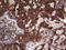 Galectin 3 antibody, LS-C798181, Lifespan Biosciences, Immunohistochemistry paraffin image 