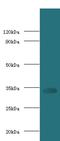 CD74 antibody, orb241249, Biorbyt, Western Blot image 