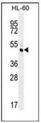 Ras And Rab Interactor Like antibody, AP53670PU-N, Origene, Western Blot image 