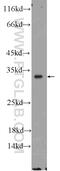Solute Carrier Family 25 Member 22 antibody, 25402-1-AP, Proteintech Group, Western Blot image 