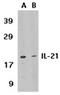 Interleukin 21 antibody, ADI-905-307-100, Enzo Life Sciences, Western Blot image 