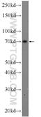 Ankyrin Repeat Domain 13B antibody, 25737-1-AP, Proteintech Group, Western Blot image 