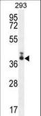 Store-Operated Calcium Entry Associated Regulatory Factor antibody, LS-C162020, Lifespan Biosciences, Western Blot image 