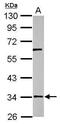 RNA Pseudouridine Synthase D3 antibody, PA5-32069, Invitrogen Antibodies, Western Blot image 