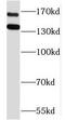 PZP Alpha-2-Macroglobulin Like antibody, FNab06763, FineTest, Western Blot image 