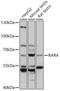 Retinoic Acid Receptor Alpha antibody, GTX54703, GeneTex, Western Blot image 