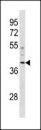 Coiled-Coil Domain Containing 83 antibody, LS-C203867, Lifespan Biosciences, Western Blot image 