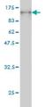 Protocadherin Beta 16 antibody, H00057717-M03, Novus Biologicals, Western Blot image 