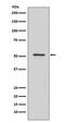 Hepatocyte Nuclear Factor 4 Alpha antibody, M00389, Boster Biological Technology, Western Blot image 