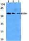 Keratin 84 antibody, PA5-37253, Invitrogen Antibodies, Western Blot image 