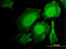Hematopoietic Cell-Specific Lyn Substrate 1 antibody, LS-C133234, Lifespan Biosciences, Immunofluorescence image 