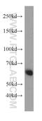 Sequestosome 1 antibody, 18420-1-AP, Proteintech Group, Western Blot image 