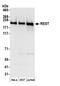 RE1 Silencing Transcription Factor antibody, NB100-757, Novus Biologicals, Western Blot image 