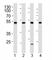 Cyclin Dependent Kinase 9 antibody, F44552-0.4ML, NSJ Bioreagents, Western Blot image 