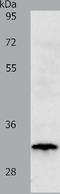 TIMP Metallopeptidase Inhibitor 3 antibody, TA321115, Origene, Western Blot image 