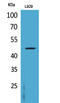 Colony Stimulating Factor 2 Receptor Alpha Subunit antibody, STJ96627, St John