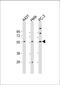 Chaperonin Containing TCP1 Subunit 8 Like 2 antibody, 61-276, ProSci, Western Blot image 