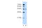 Solute Carrier Family 17 Member 4 antibody, 29-919, ProSci, Western Blot image 