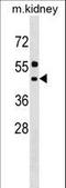 Asparagine-linked glycosylation protein 11 homolog antibody, LS-C161036, Lifespan Biosciences, Western Blot image 