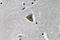 Rho Associated Coiled-Coil Containing Protein Kinase 1 antibody, LS-C291734, Lifespan Biosciences, Immunohistochemistry frozen image 