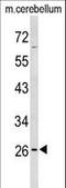 Peroxisomal Membrane Protein 4 antibody, LS-C162335, Lifespan Biosciences, Western Blot image 