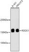 Rho Associated Coiled-Coil Containing Protein Kinase 1 antibody, 13-936, ProSci, Western Blot image 