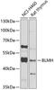 Bleomycin Hydrolase antibody, 22-293, ProSci, Western Blot image 