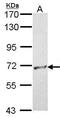 RB Binding Protein 5, Histone Lysine Methyltransferase Complex Subunit antibody, GTX102440, GeneTex, Western Blot image 