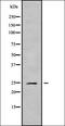 Potassium Voltage-Gated Channel Subfamily J Member 14 antibody, orb338057, Biorbyt, Western Blot image 