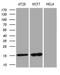 Anterior Gradient 2, Protein Disulphide Isomerase Family Member antibody, LS-C795146, Lifespan Biosciences, Western Blot image 
