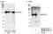 Protein Phosphatase 6 Regulatory Subunit 2 antibody, NB100-41415, Novus Biologicals, Western Blot image 