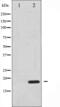 Eukaryotic Translation Initiation Factor 4E Binding Protein 1 antibody, abx010311, Abbexa, Western Blot image 