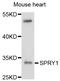 Sprouty RTK Signaling Antagonist 1 antibody, STJ112316, St John