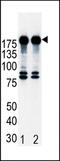 ERBB2 antibody, TA324958, Origene, Western Blot image 