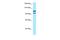 Myosin X antibody, A03647, Boster Biological Technology, Western Blot image 